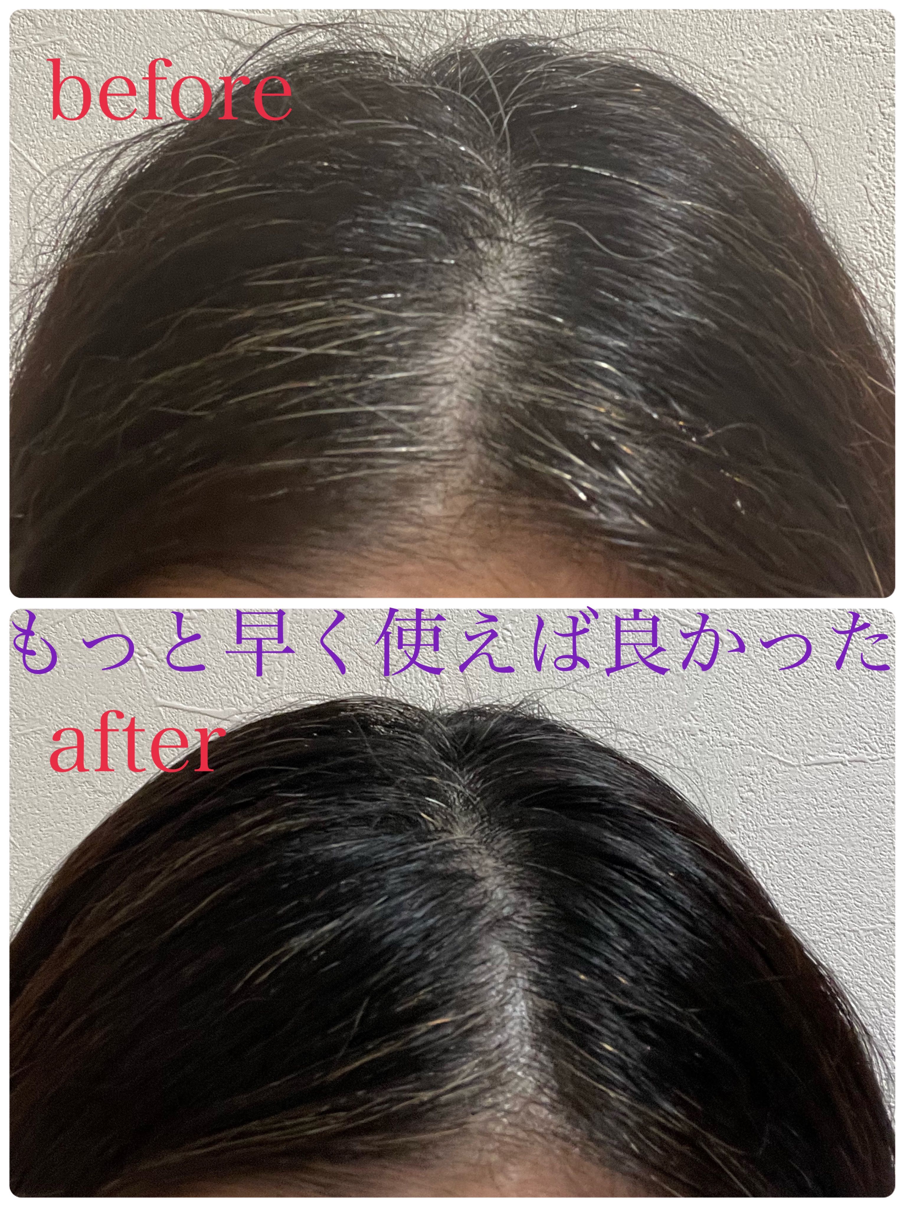 カラートリートメント リタッチ用/CIELO/ヘアカラーを使ったクチコミ（1枚目）