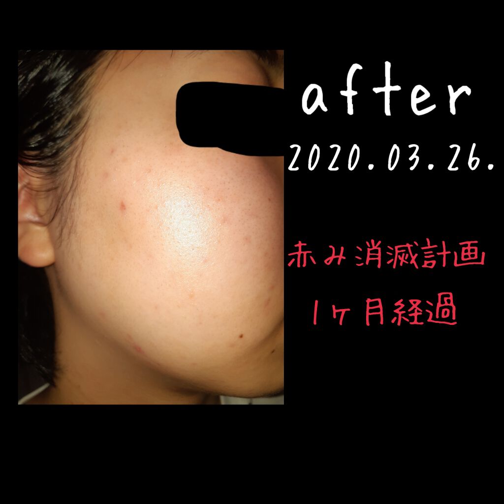 ハトムギ化粧水(ナチュリエ スキンコンディショナー R )/ナチュリエ/化粧水を使ったクチコミ(3枚目)