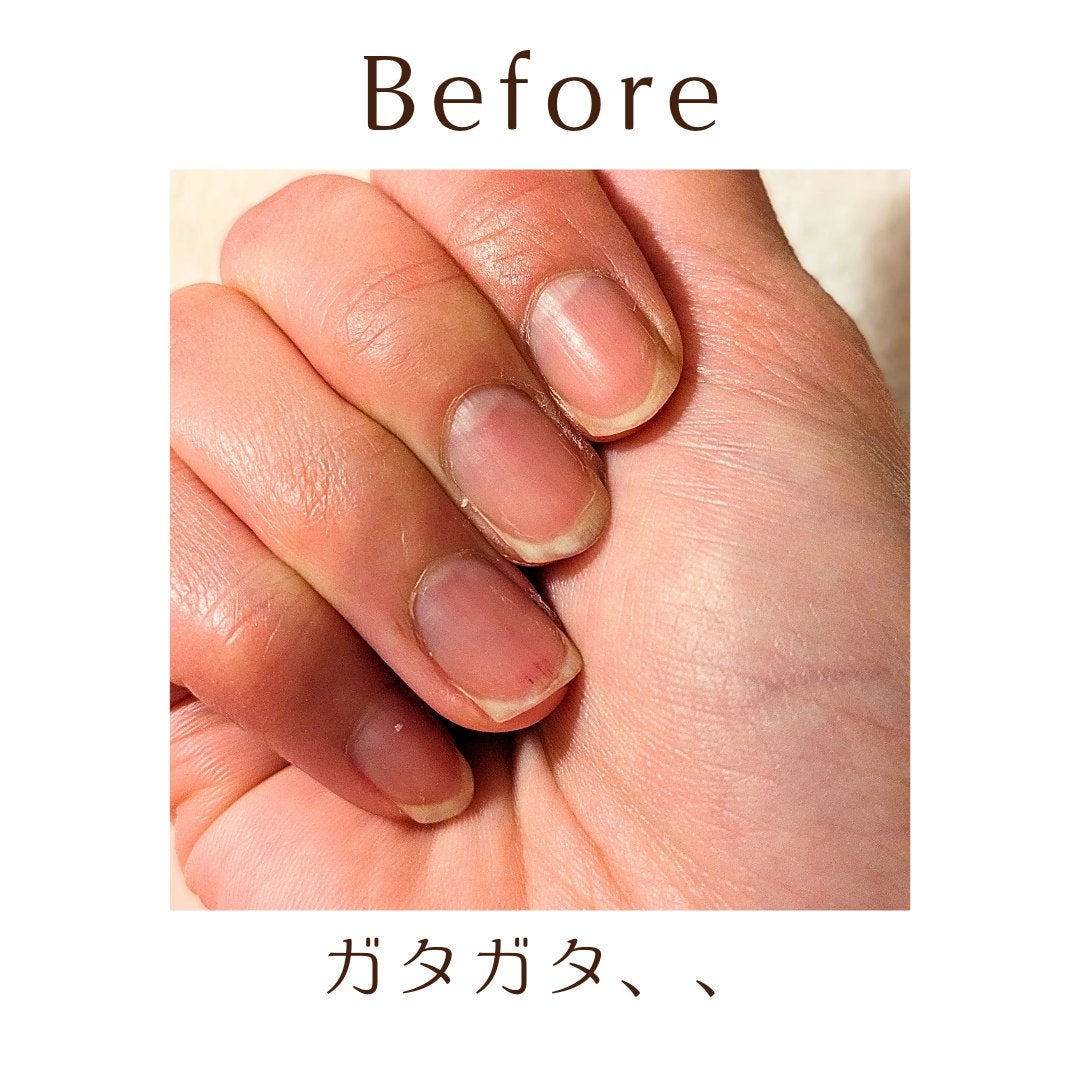 シア ネイルオイル/L'OCCITANE/ネイルオイル・トリートメントを使ったクチコミ(3枚目)