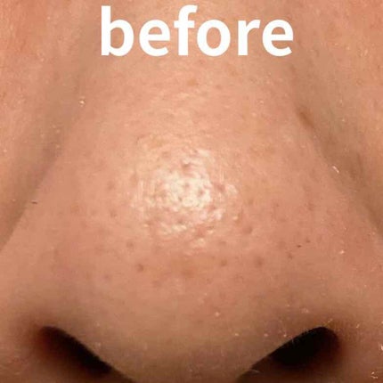 ホホバオイル/無印良品/ボディオイルを使ったクチコミ(2枚目)