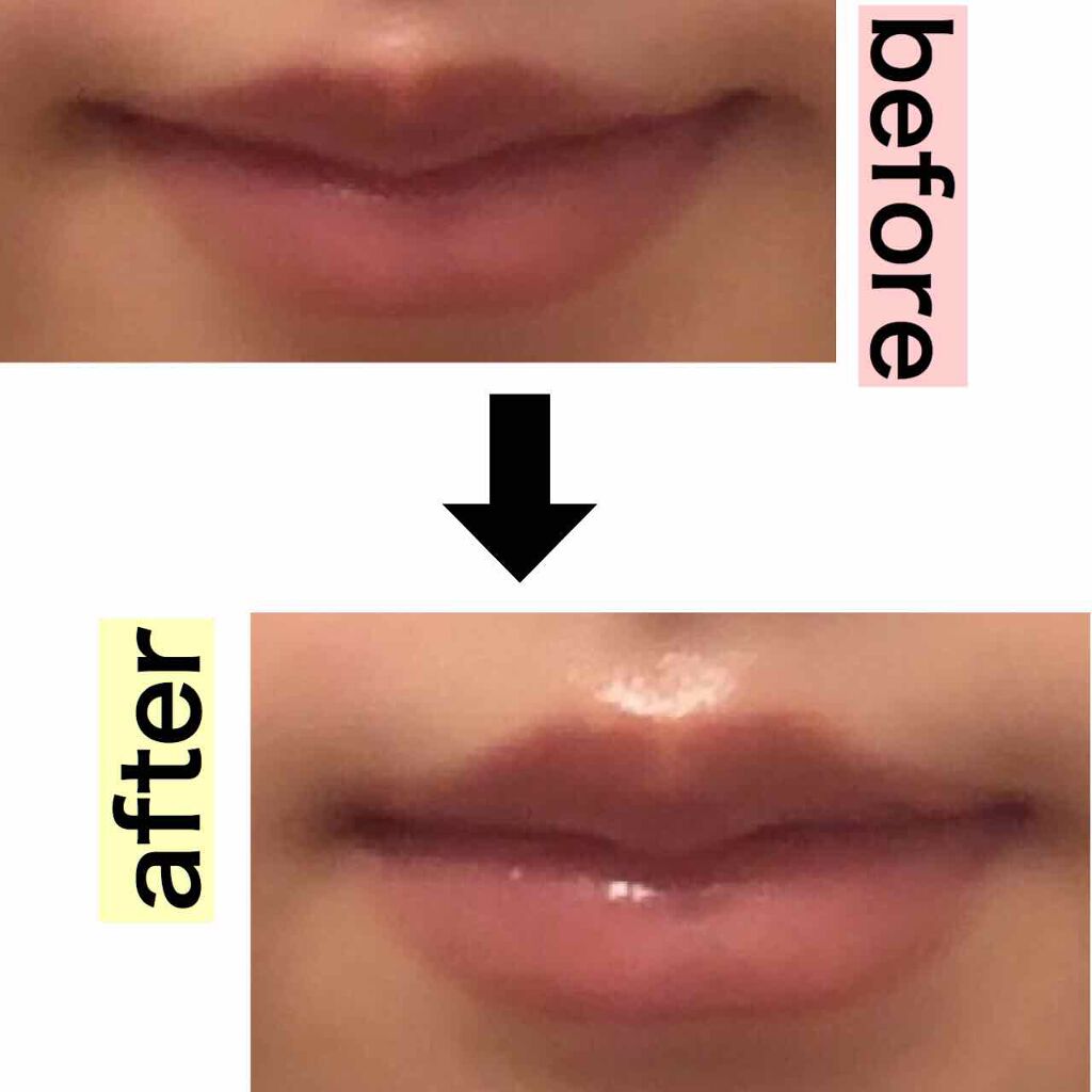 スティックプランパー エクストラセラム/Borica/リッププランパーを使ったクチコミ(3枚目)