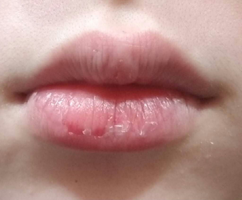 DHC 薬用リップクリーム/DHC/リップクリームを使ったクチコミ（2枚目）