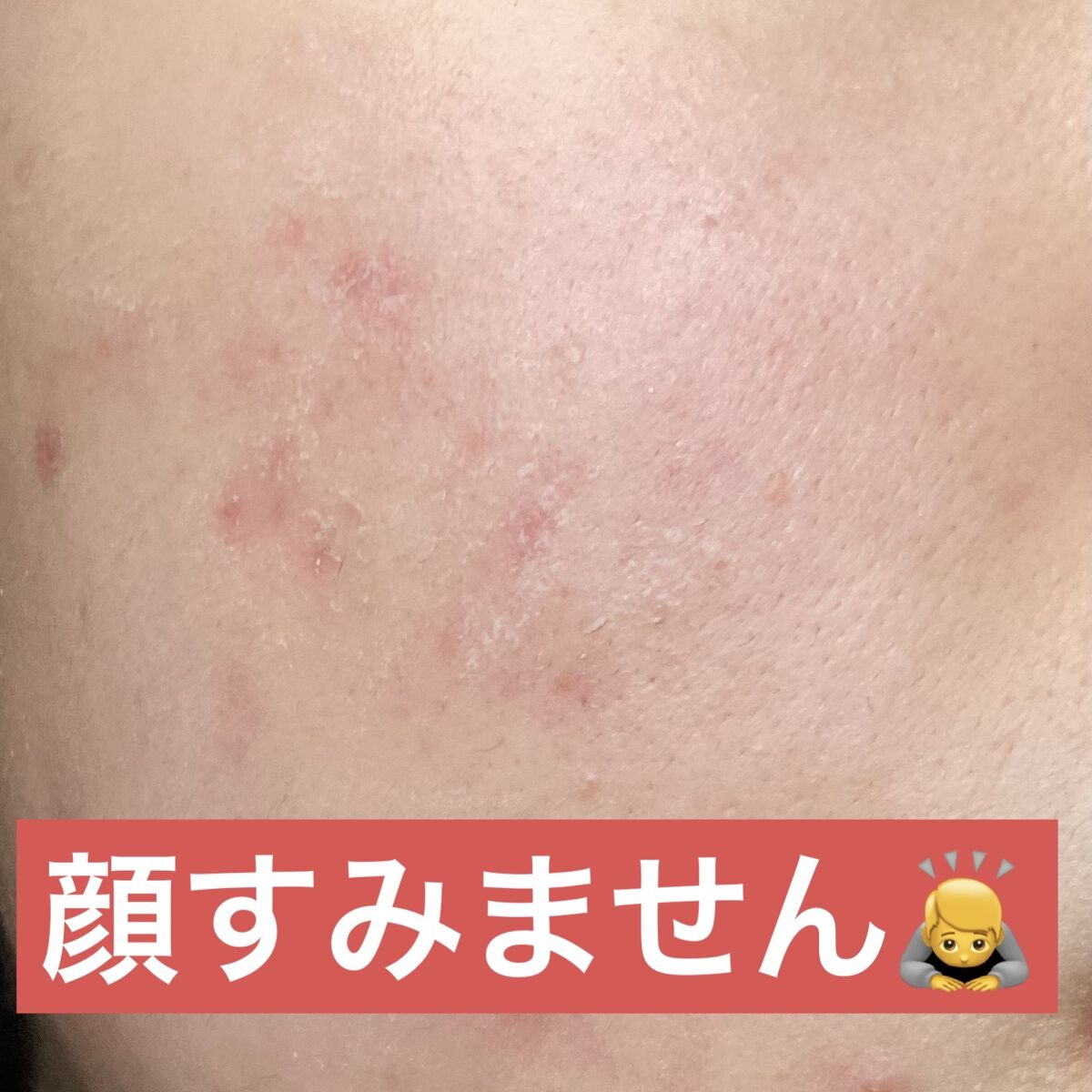 ライトリフレクティングセッティングパウダー　プレスト　N/NARS/プレストパウダーを使ったクチコミ（2枚目）