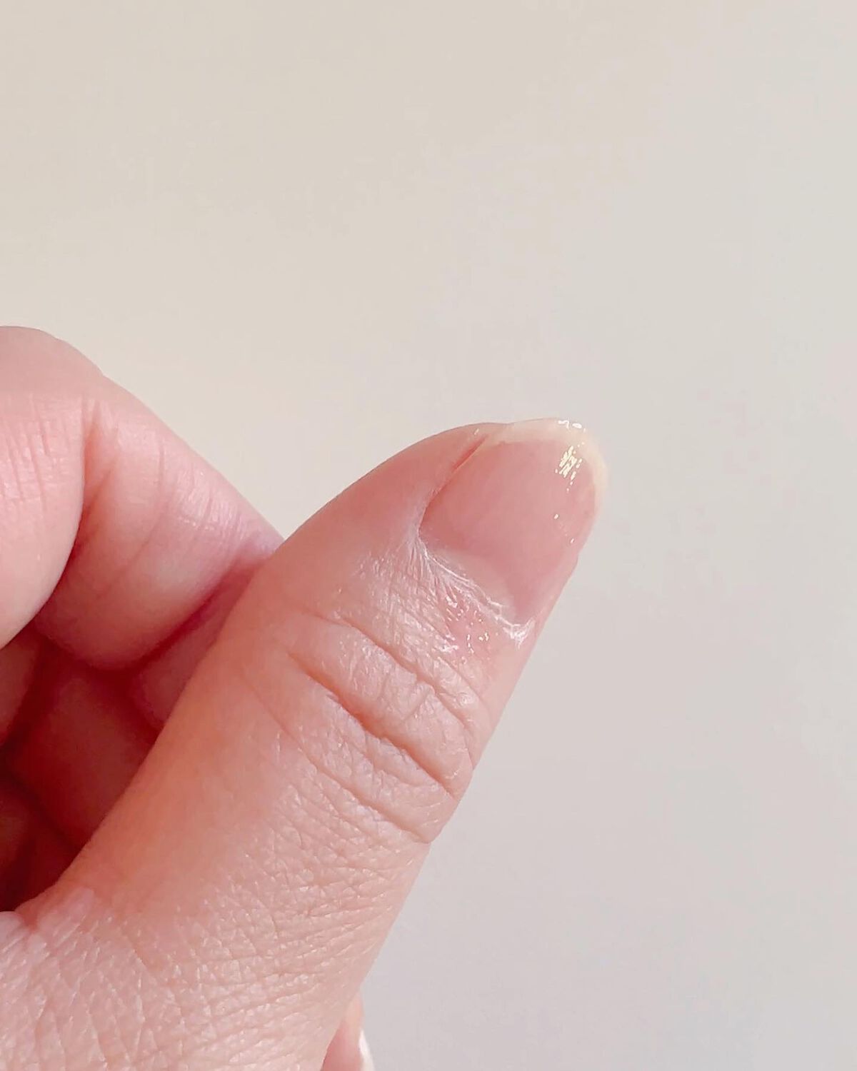 1Day密封ネイルケアパック/DAILY NAILLY/ネイルオイル・トリートメントを使ったクチコミ(5枚目)