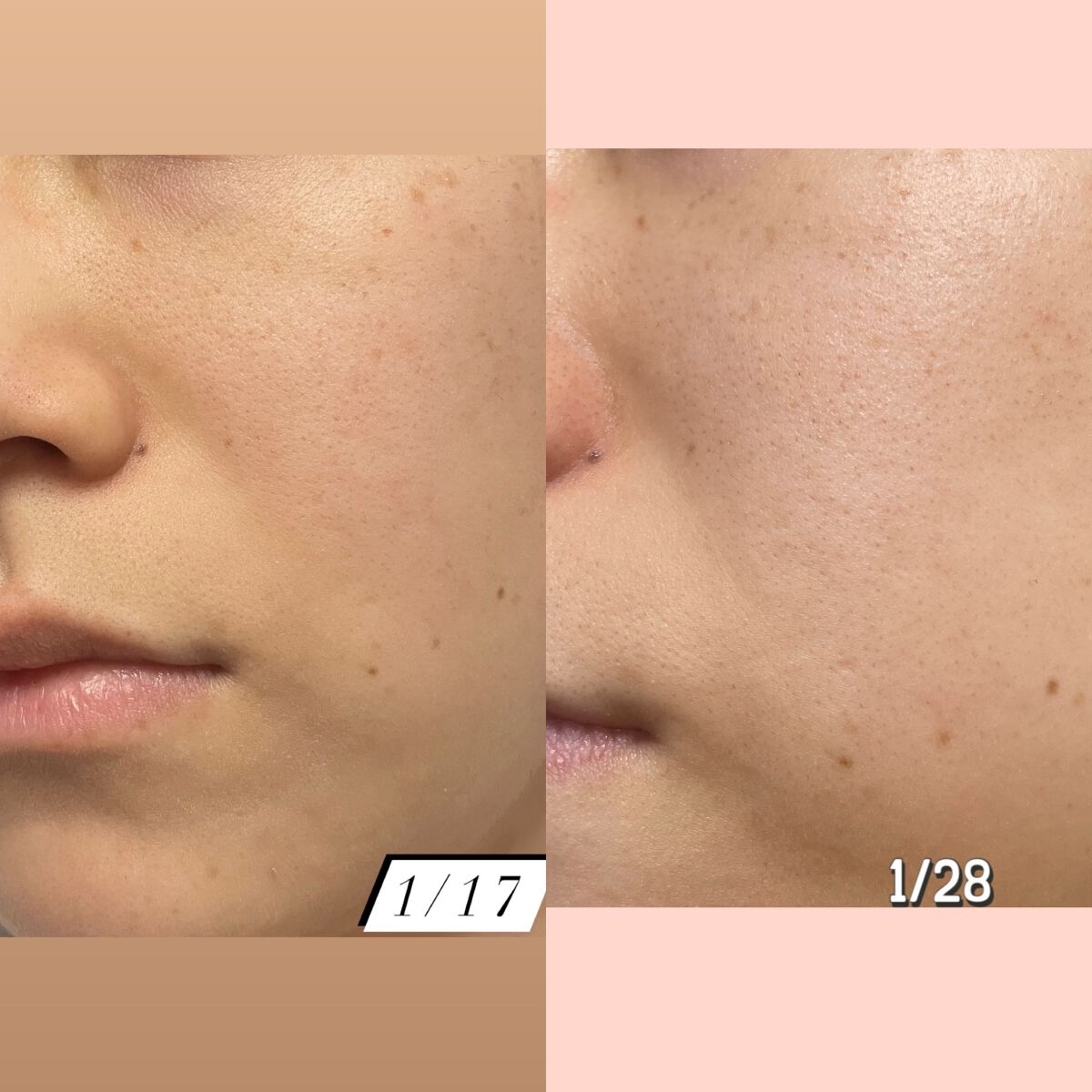 ユース ラディアンス ビタチノール セラム/primera/美容液を使ったクチコミ(6枚目)