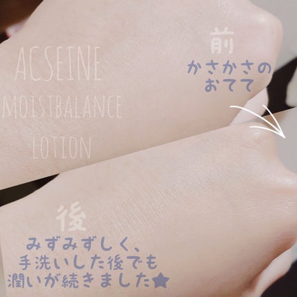 モイストバランス ローション/ACSEINE/化粧水を使ったクチコミ(3枚目)