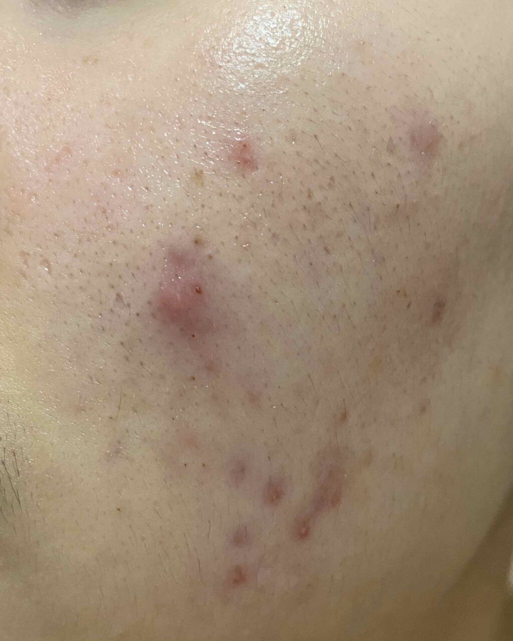 敏感肌用薬用美白美容液/無印良品/美容液を使ったクチコミ(4枚目)