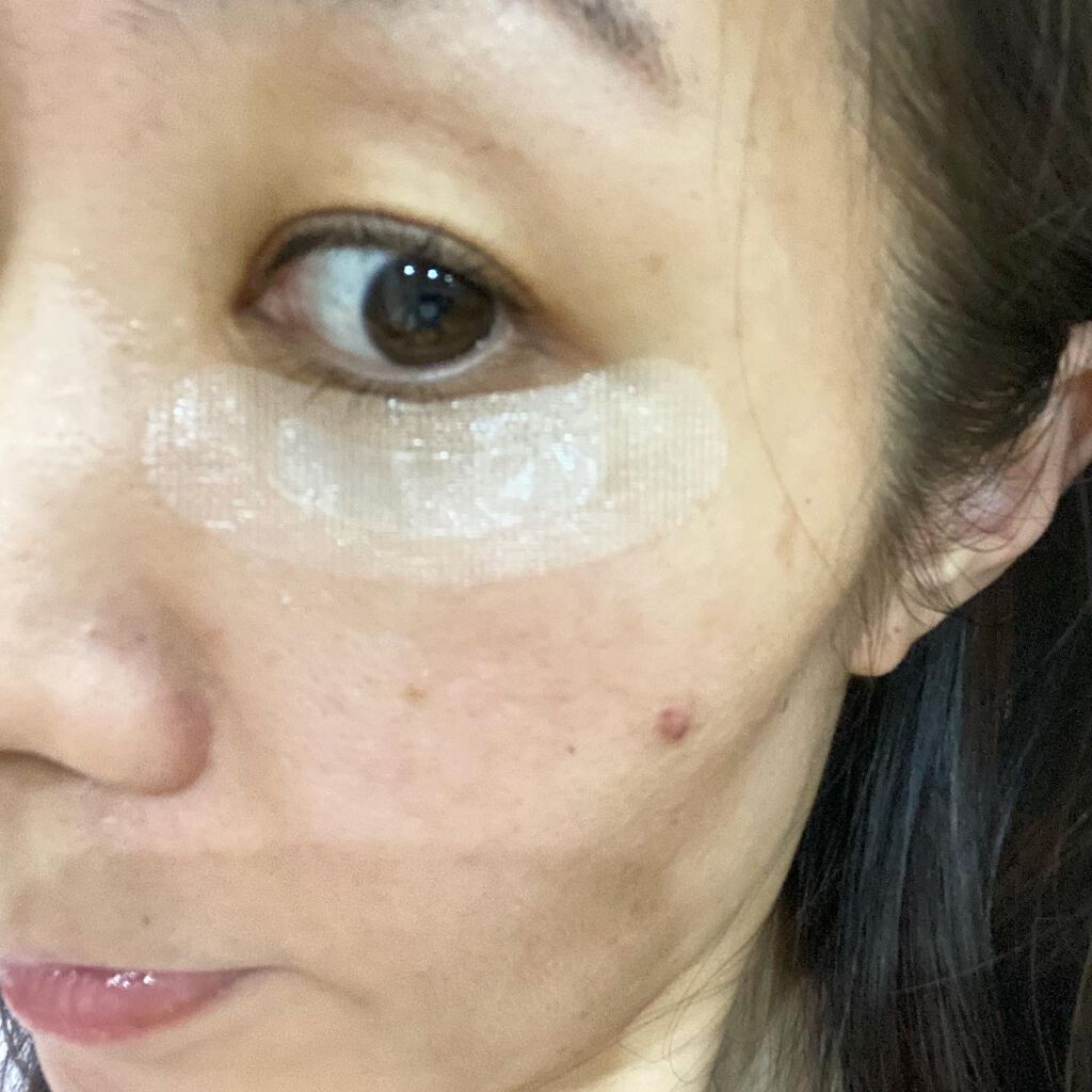 クリアターン ヒアロチューン マイクロパッチ 1500/クリアターン/シートマスク・パックを使ったクチコミ(5枚目)