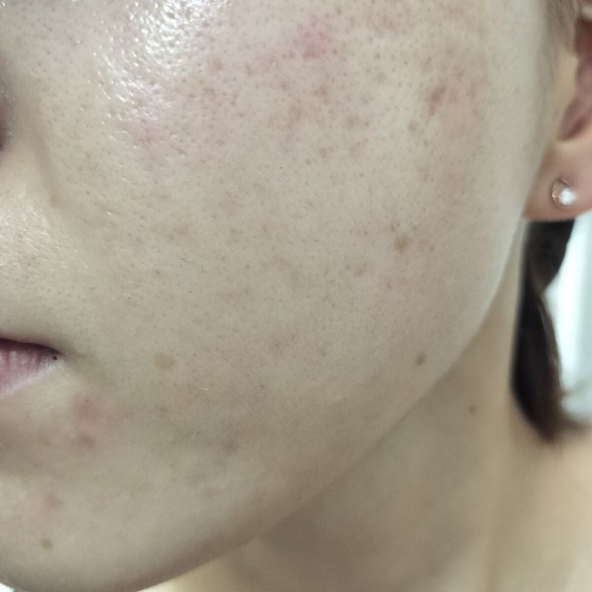 miina@汚肌工事録⚠️ on LIPS 「10/15の#汚肌工事録きょうもおつかれさまです。☕/フライト..」(2枚目)