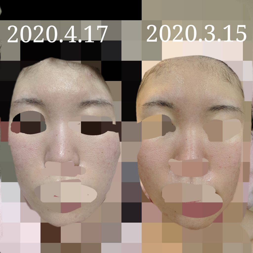 エバレッシュホワイトEXⅡ(医薬品)/matsukiyo/その他を使ったクチコミ（1枚目）