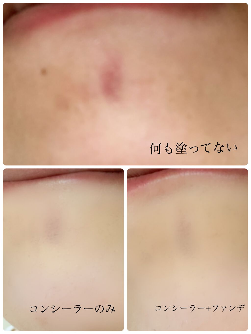 【旧】ディオールスキン フォーエヴァー スキン コレクト コンシーラー/Dior/リキッドコンシーラーを使ったクチコミ(2枚目)