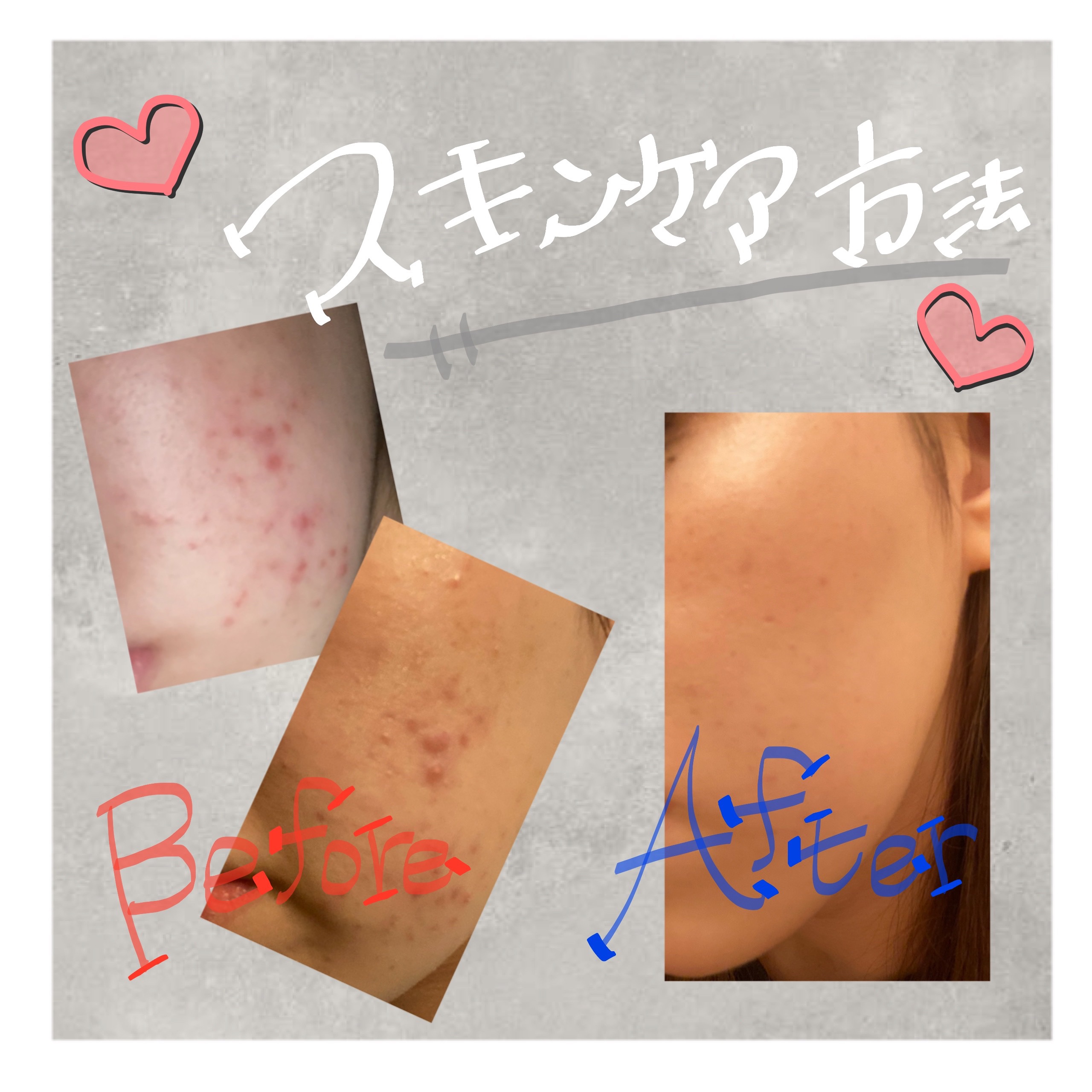 ピーリングソープ/セルニュープラス/洗顔石鹸を使ったクチコミ（1枚目）