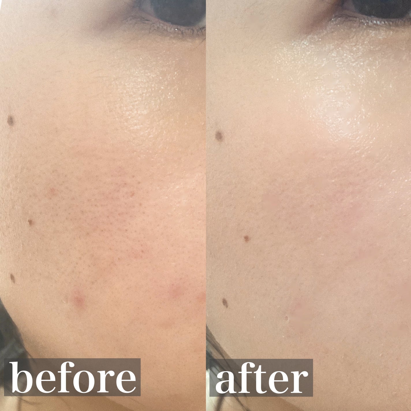 ブラーフィニッシュ雲楚クッション/Dinto/クッションファンデーションを使ったクチコミ(4枚目)