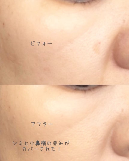 ダーマシンコンシーラー/23years old/リキッドコンシーラーを使ったクチコミ(5枚目)