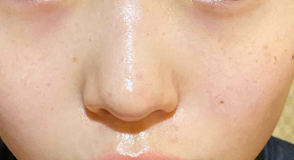 なさ on LIPS 「肌改善計画6日目さぁさぁ今晩もやってまいりました肌改善計画どう..」(4枚目)