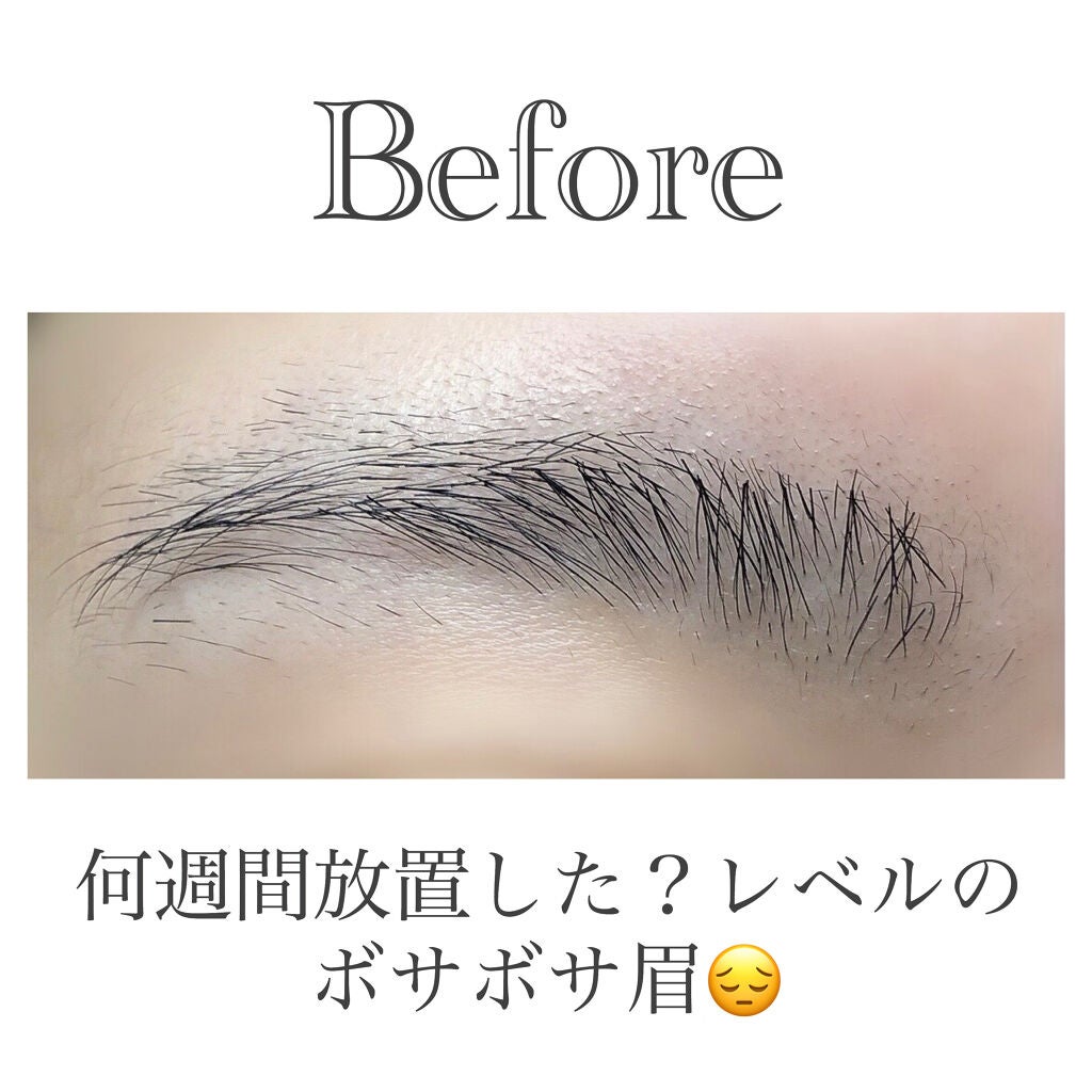 プレミア敏感肌用 Lディスポ/シック/シェーバーを使ったクチコミ(2枚目)