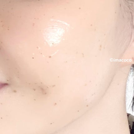 リアルシカペストパック/ビューランチ/洗い流すパック・マスクを使ったクチコミ(4枚目)