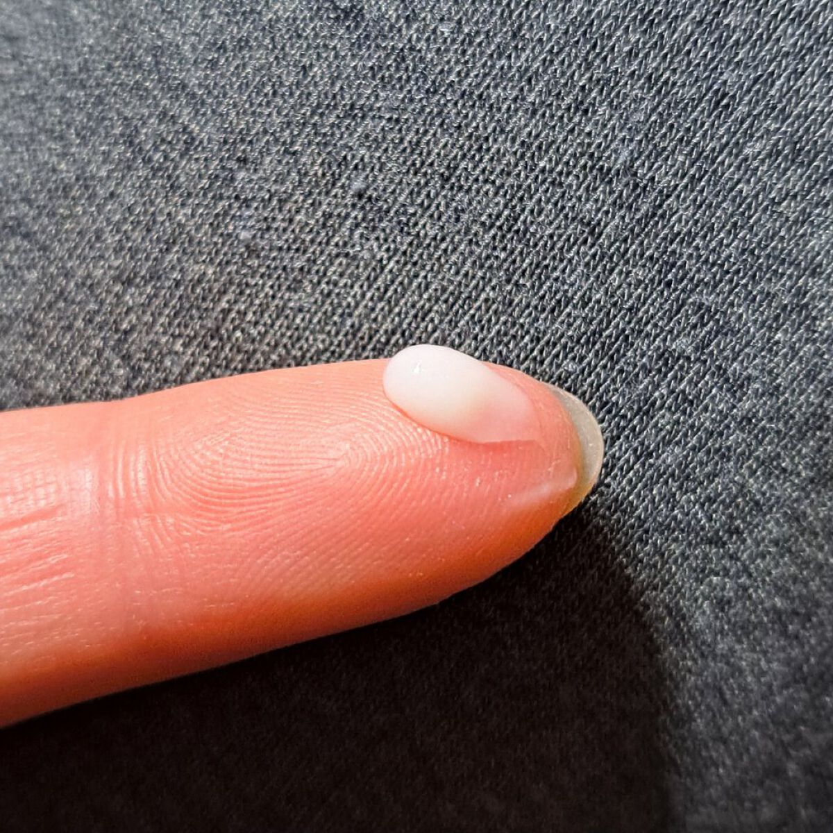 クロキュアEX(医薬品)/クロキュア/その他を使ったクチコミ（3枚目）