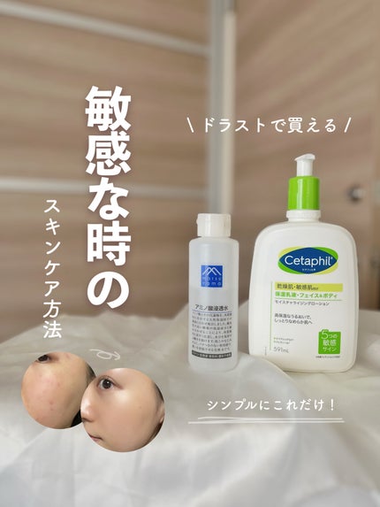 モイスチャライジングローション/セタフィル/ボディローションを使ったクチコミ(1枚目)