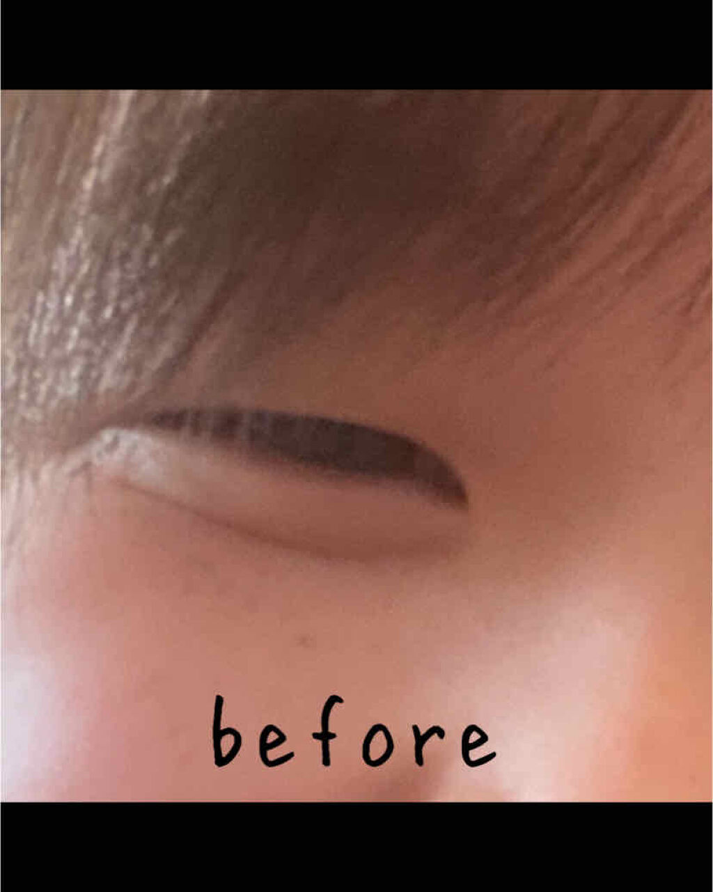 肌色タイプ/バンドエイド/その他を使ったクチコミ（2枚目）