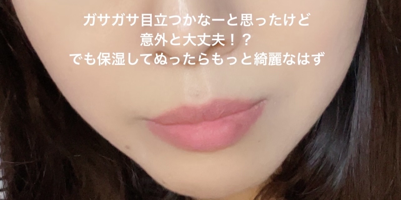 グロウ フィクシングティント/ETUDE/リップティントを使ったクチコミ（3枚目）