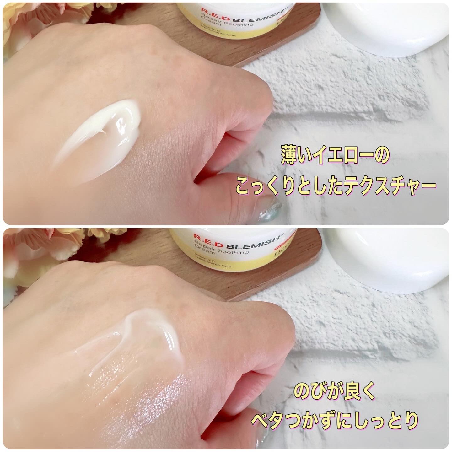 レッドブレミッシュ リペアスージングクリーム/Dr.G/フェイスクリームを使ったクチコミ（3枚目）