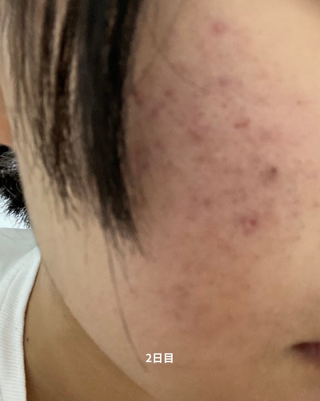 白色ワセリン(医薬品)/健栄製薬/その他を使ったクチコミ(3枚目)