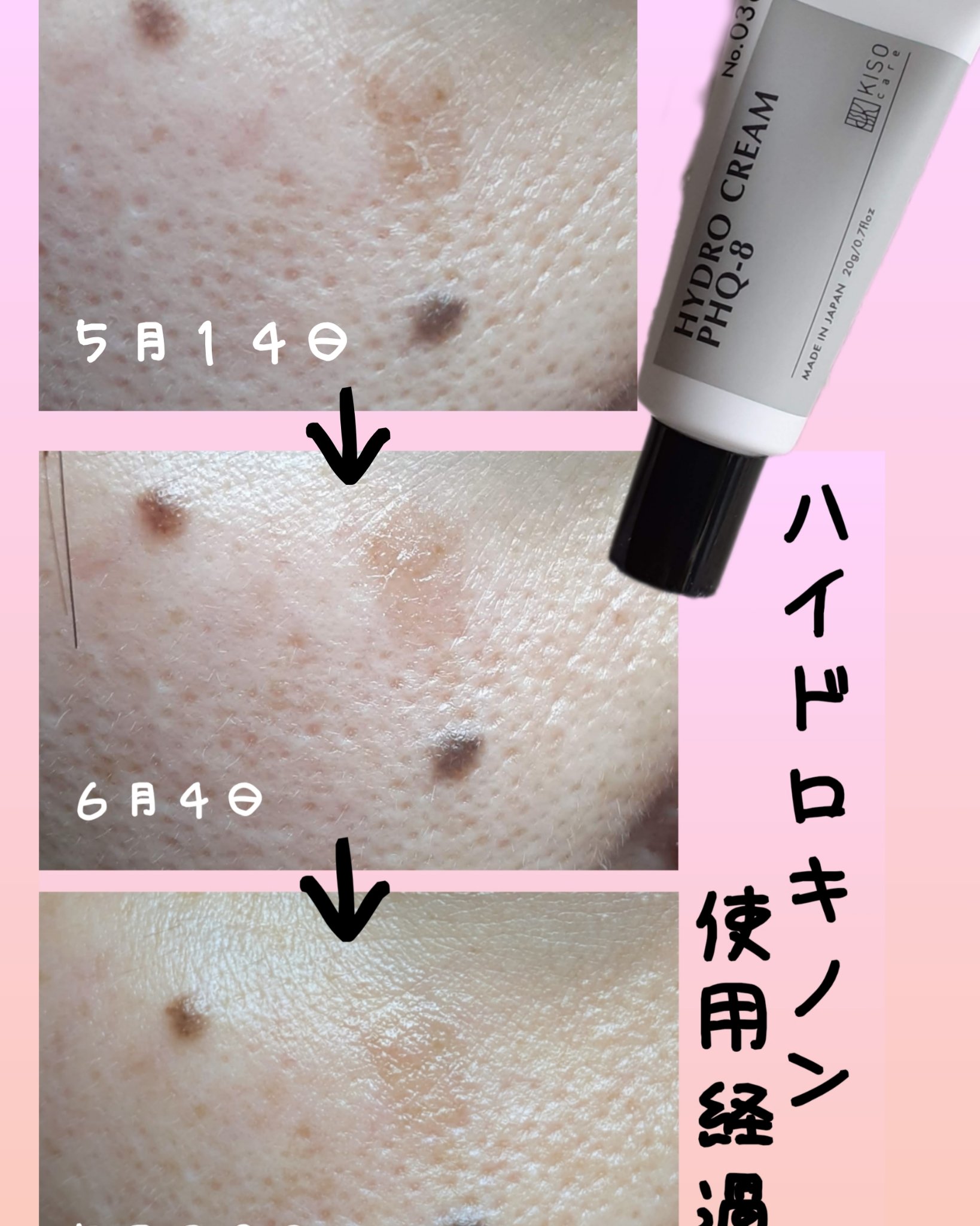 ハイドロクリームPHQ-8/KISO/美容液を使ったクチコミ（3枚目）