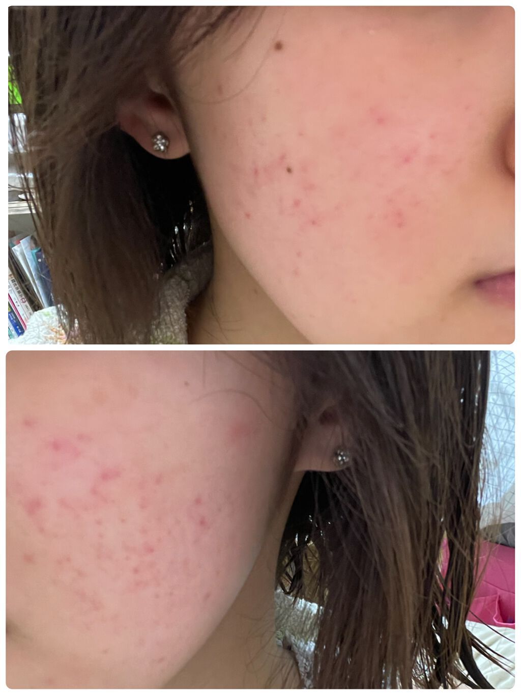 白潤プレミアム薬用浸透美白化粧水/肌ラボ/化粧水を使ったクチコミ（2枚目）