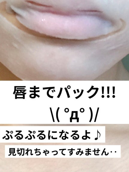 R:NA ブライトニングニングマスク/MEDIHEAL/シートマスク・パックを使ったクチコミ(4枚目)