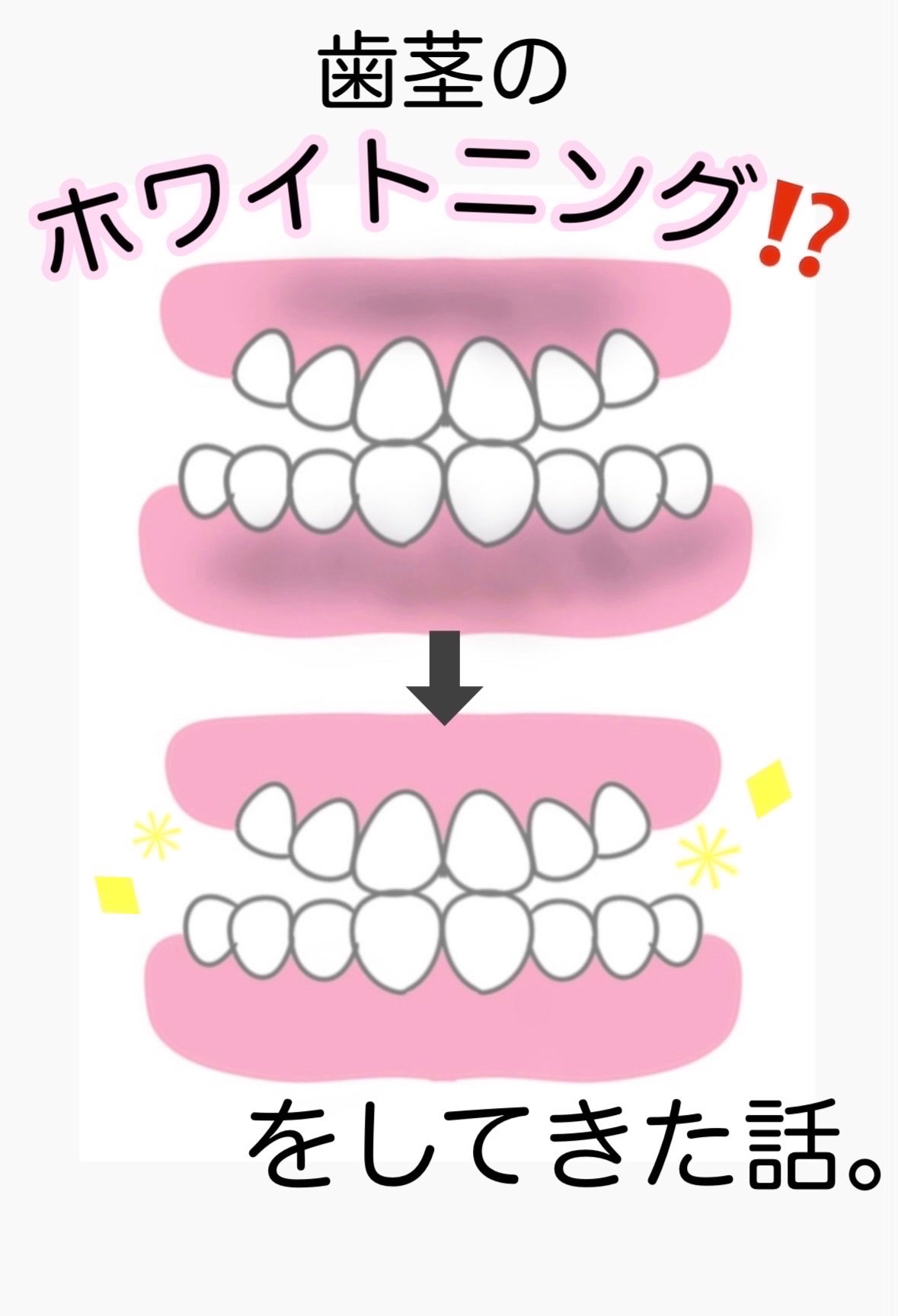 アドバンテージハブラシ コンパクト/クリニカ/歯ブラシを使ったクチコミ(1枚目)