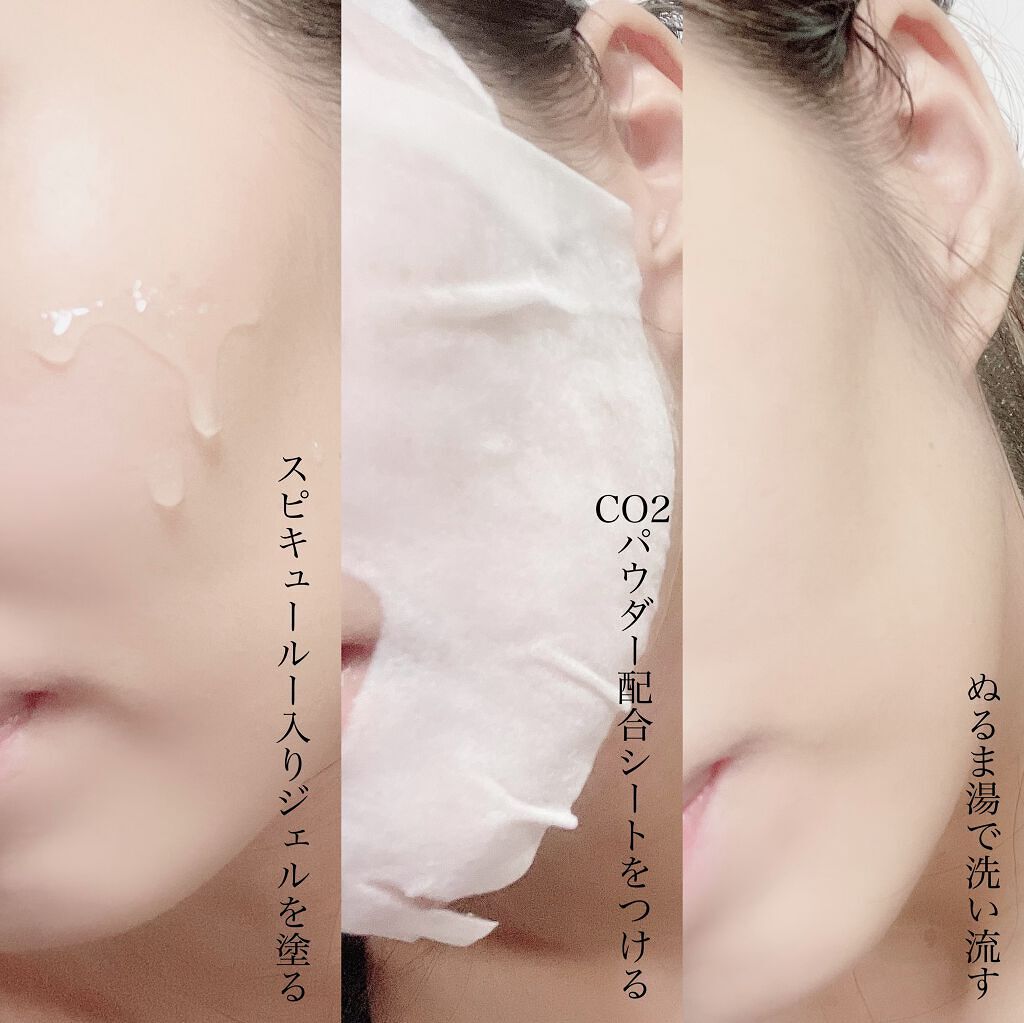 リフトブライトCO2パック/yourline/シートマスク・パックを使ったクチコミ(4枚目)