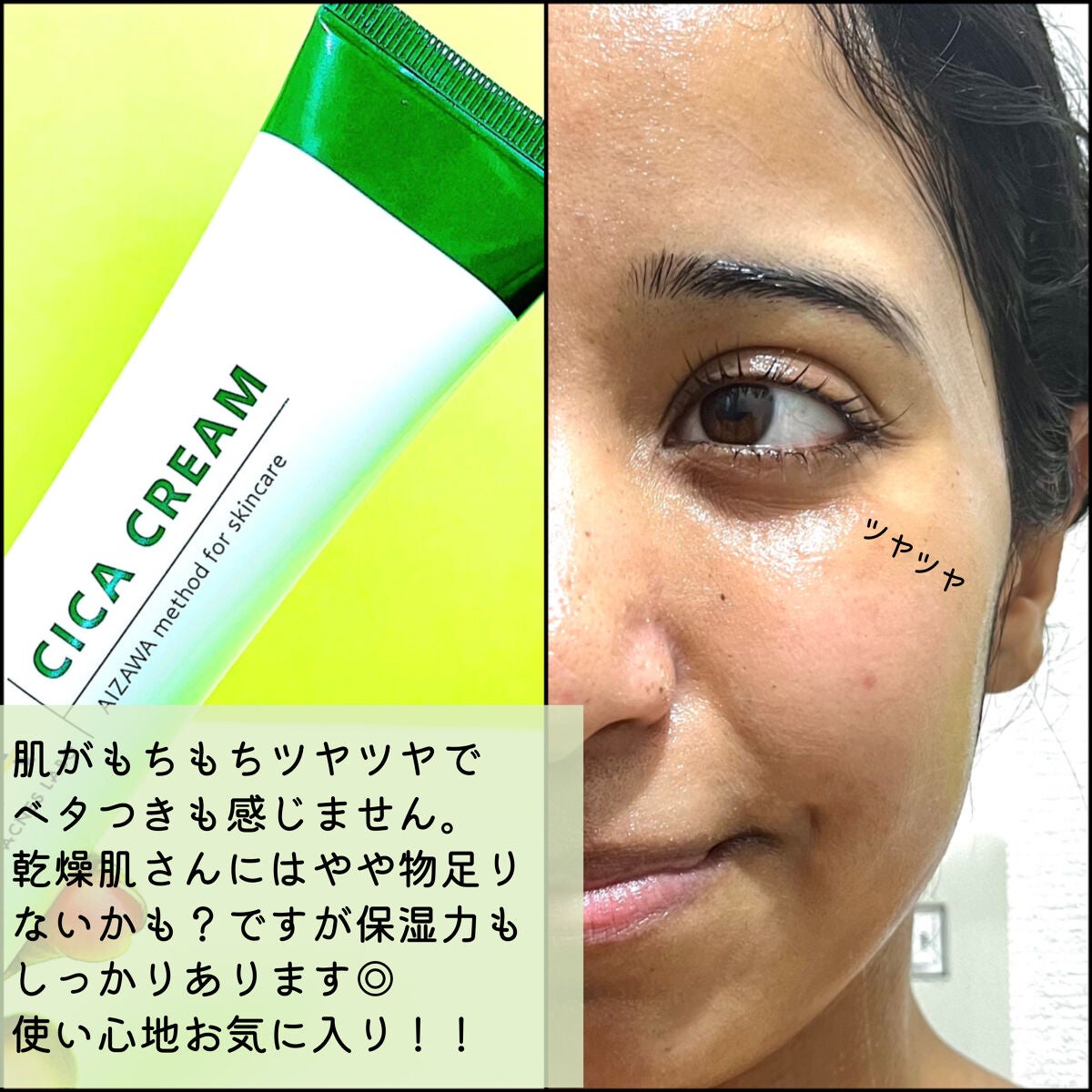 薬用CICAクリーム/アクネスラボ/フェイスクリームを使ったクチコミ(6枚目)