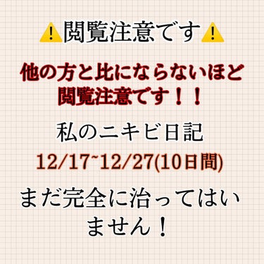 ニベア クリームケア洗顔料 しっとり/ニベア/洗顔フォームを使ったクチコミ（1枚目）