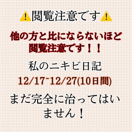 ハトムギ化粧水(ナチュリエ スキンコンディショナー R )/ナチュリエ/化粧水を使ったクチコミ(1枚目)