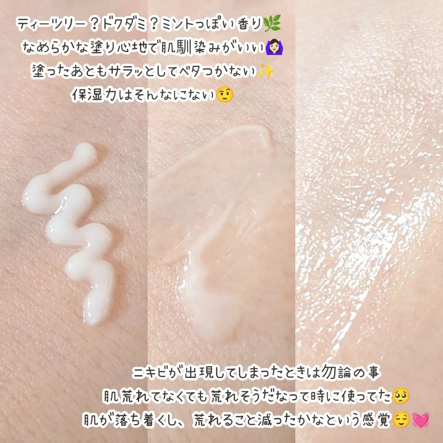 SOSスポットクリアクリーム/One-day's you/フェイスクリームを使ったクチコミ（2枚目）