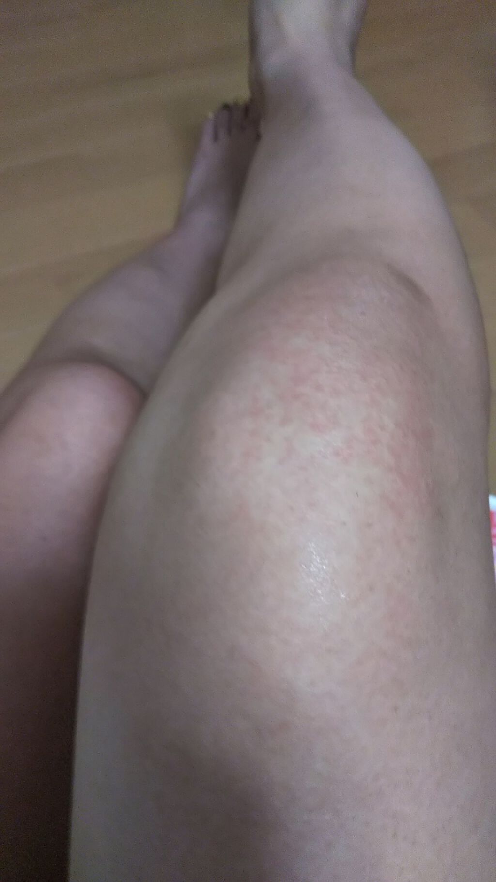 除毛クリーム シトラスホワイトリリィ/スリンキータッチ セルフスパ/除毛クリームを使ったクチコミ(4枚目)