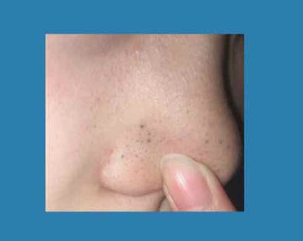 おうちdeエステ 肌をなめらかにする マッサージ洗顔ジェル/ビオレ/その他洗顔料を使ったクチコミ(4枚目)