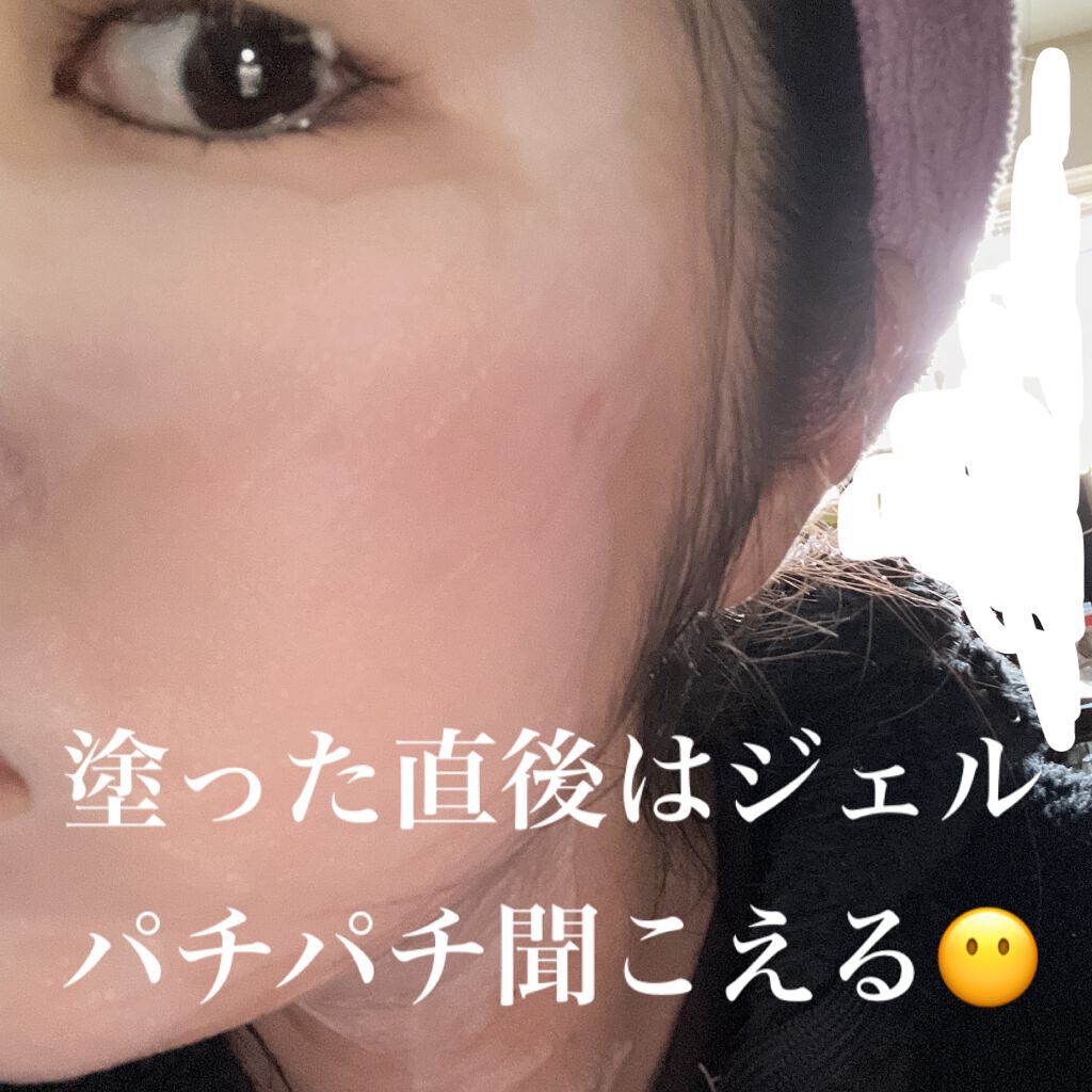 マジックバブルエッセンスパックMINI/BAKER7/シートマスク・パックを使ったクチコミ(2枚目)