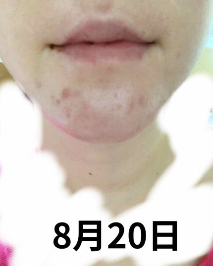 新エバユースB26 (医薬品)/エバユース/その他を使ったクチコミ(3枚目)