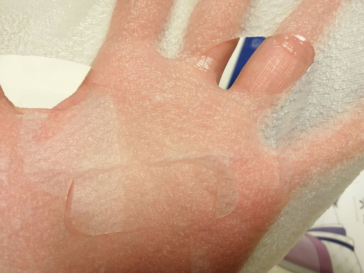 毛穴小町 テカリ源治 マスク/クリアターン/シートマスク・パックを使ったクチコミ(6枚目)