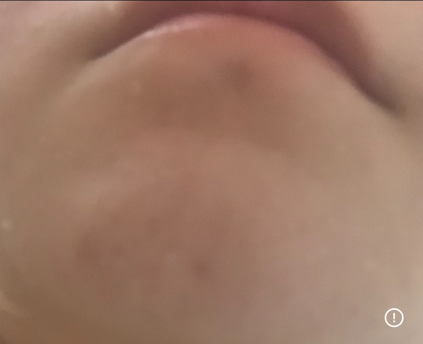 ダイブイン セラム/Torriden/美容液を使ったクチコミ（1枚目）