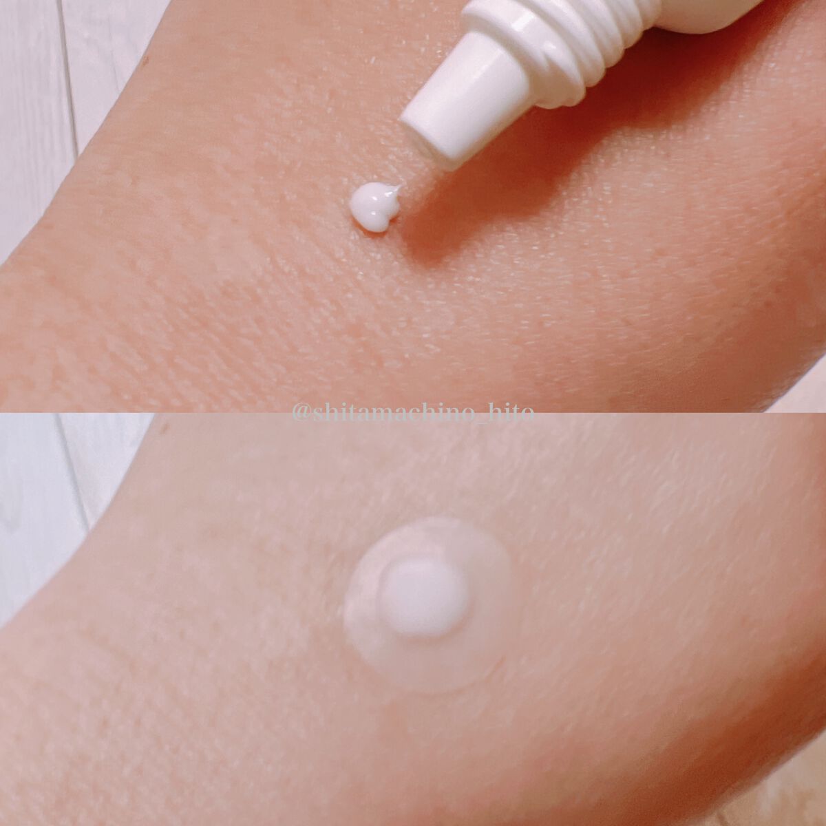 薬用 美白アクネホワイトクリーム 専用パッチ付/アクネスラボ/その他キットセットを使ったクチコミ（3枚目）