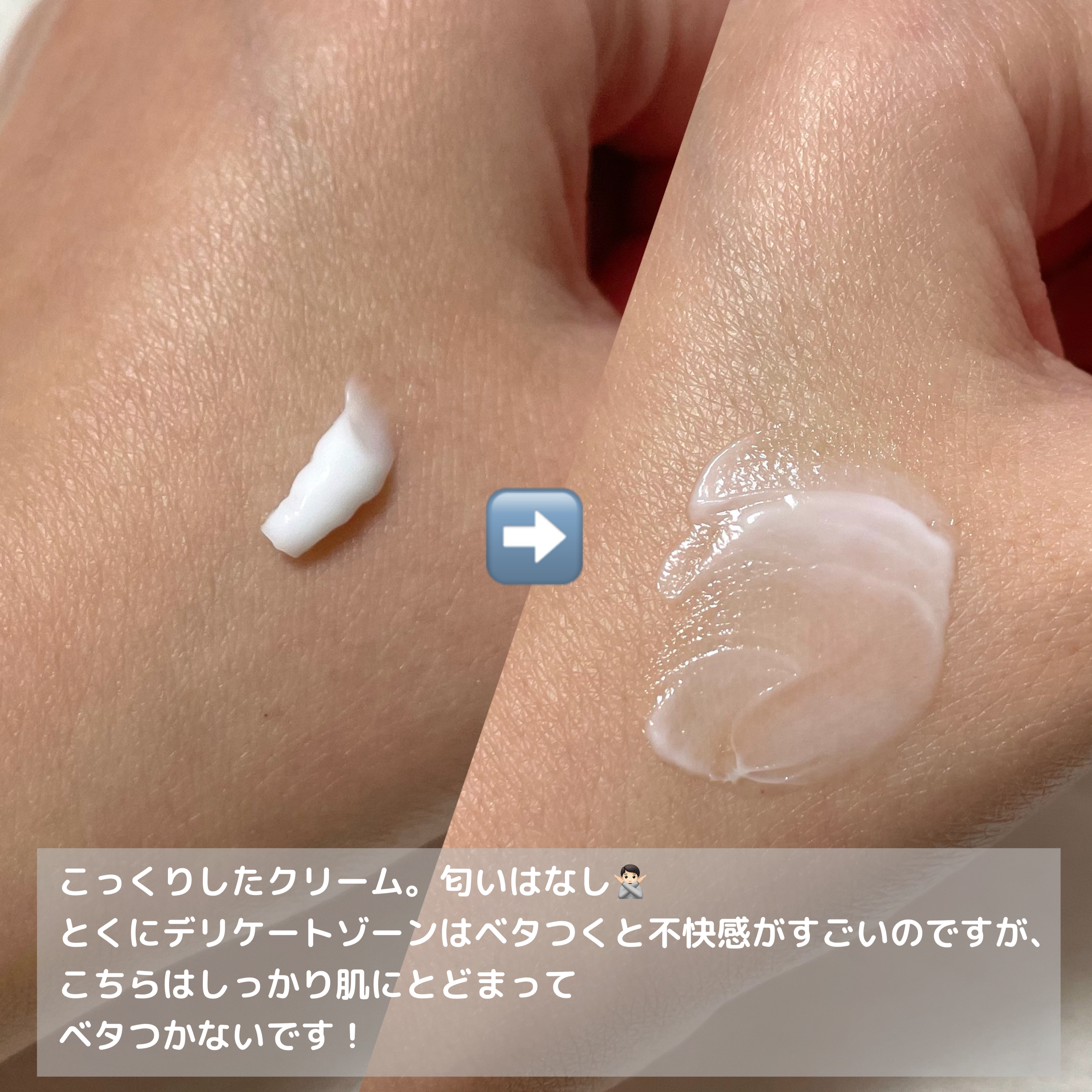 薬用ホワイトケアクリーム/DELIWHITE/デリケートゾーンケアを使ったクチコミ（3枚目）