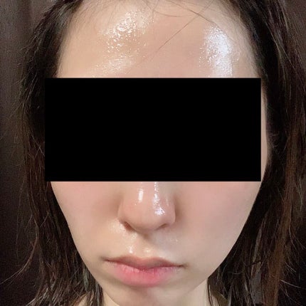 ももぷり フレッシュピールオフパック/ももぷり/ピーリングを使ったクチコミ(2枚目)