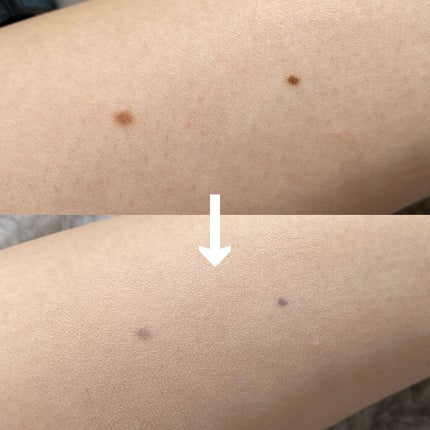 フィットミー コンシーラー/MAYBELLINE NEW YORK/リキッドコンシーラーを使ったクチコミ(7枚目)