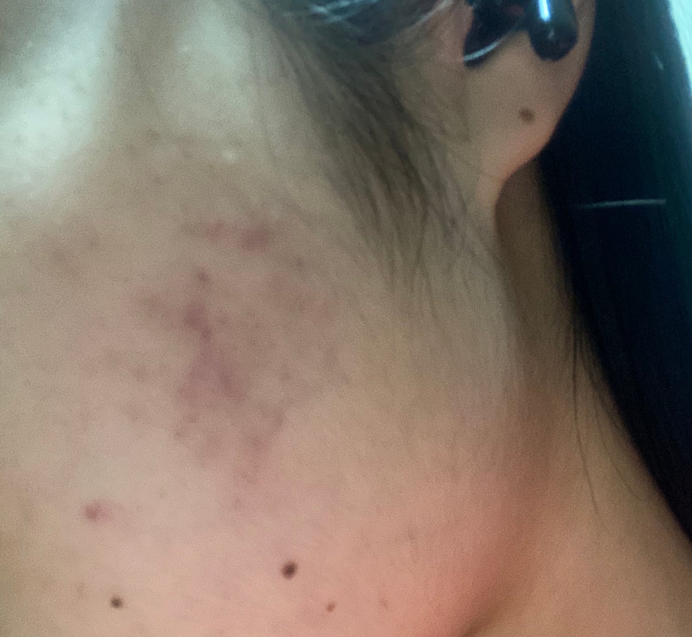 シカレチA エッセンス0.1/VT/美容液を使ったクチコミ(2枚目)