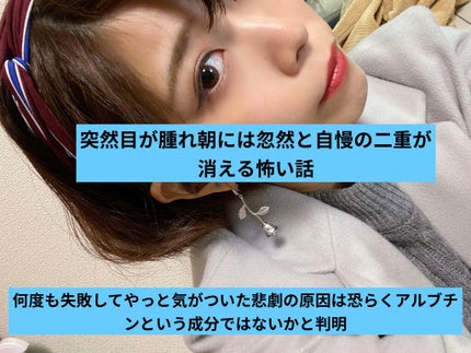 美白化粧水 W/ちふれ/化粧水を使ったクチコミ(1枚目)