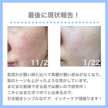 モイスチュア ローション/カルテHD/化粧水を使ったクチコミ(10枚目)