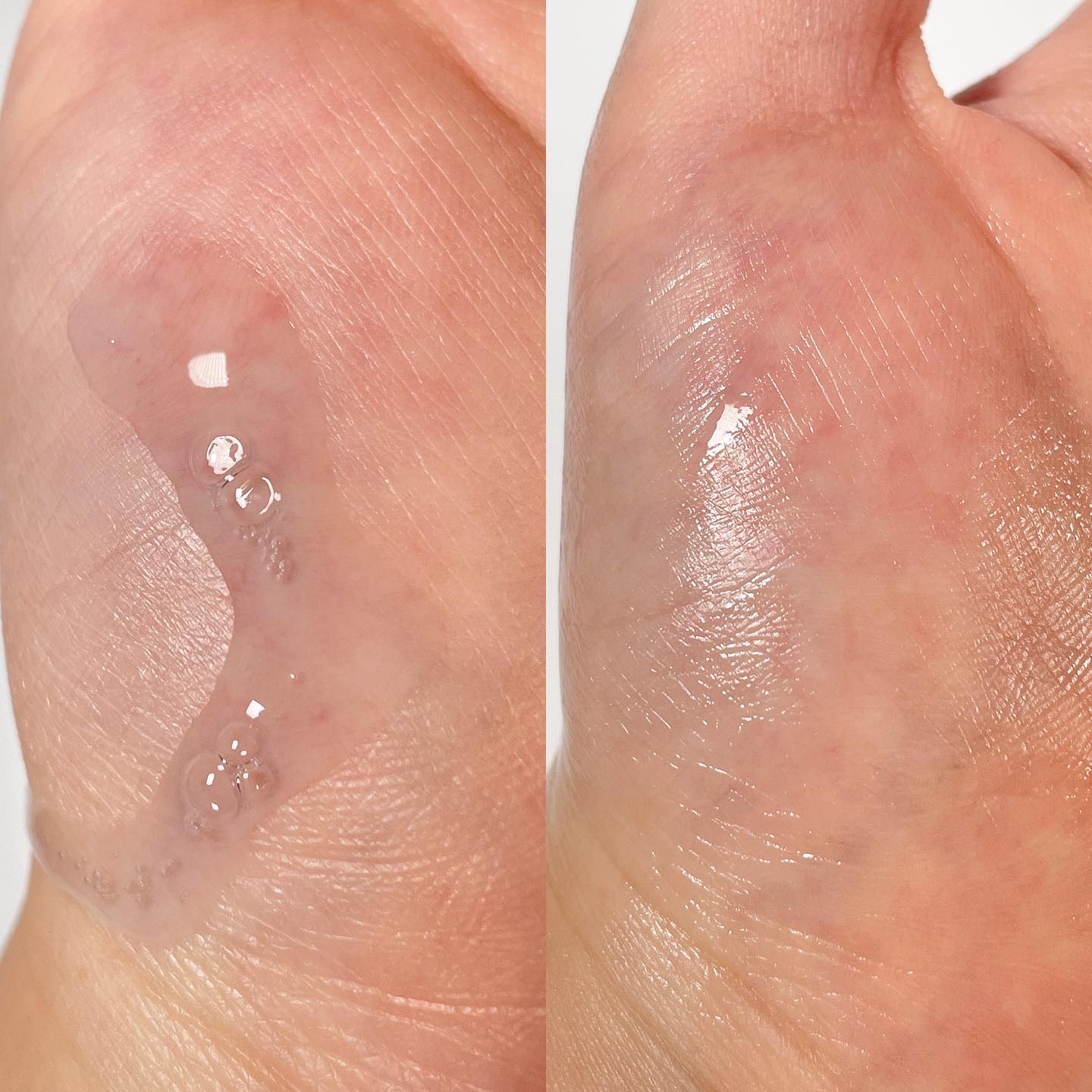 ゼロ毛穴パッド 2.0/MEDICUBE/トナーパッドを使ったクチコミ（3枚目）